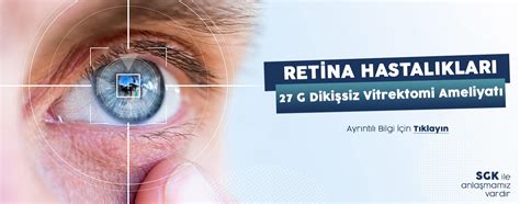 retina göz hastanesi iletişim